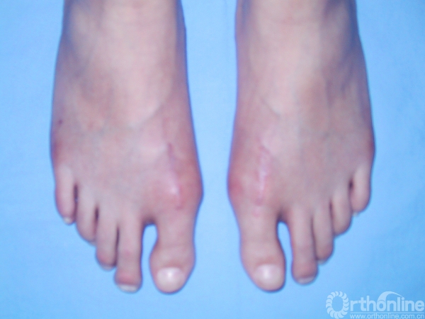 图2b  术后体位像.jpg