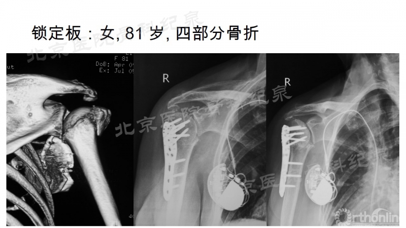 幻灯片11_副本.jpg