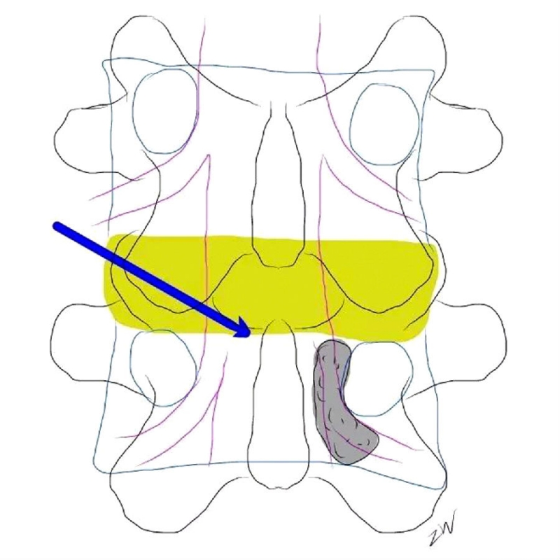 6.png