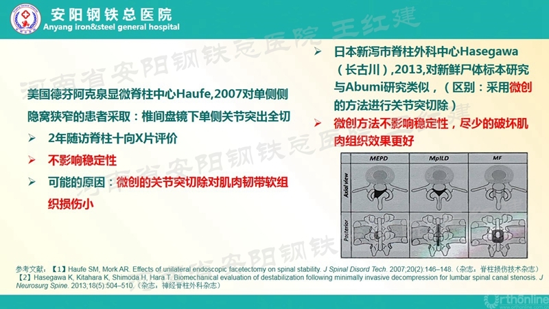 Endo--ULBD技术治疗腰椎管狭窄症的价值和边界3(第二部分)_副本.jpg