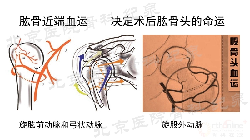 肱骨近端骨折微创OR传统中文版_页面_10_副本.jpg
