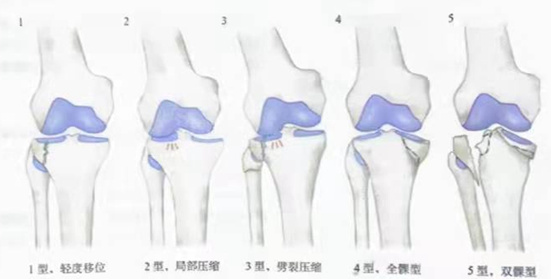 图2 moore.jpg