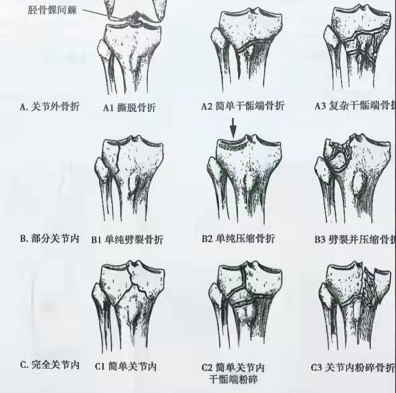 图3 ao.jpg